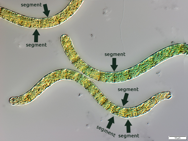 Spirulina at 10 micron magnification - Spirulina under the microscope