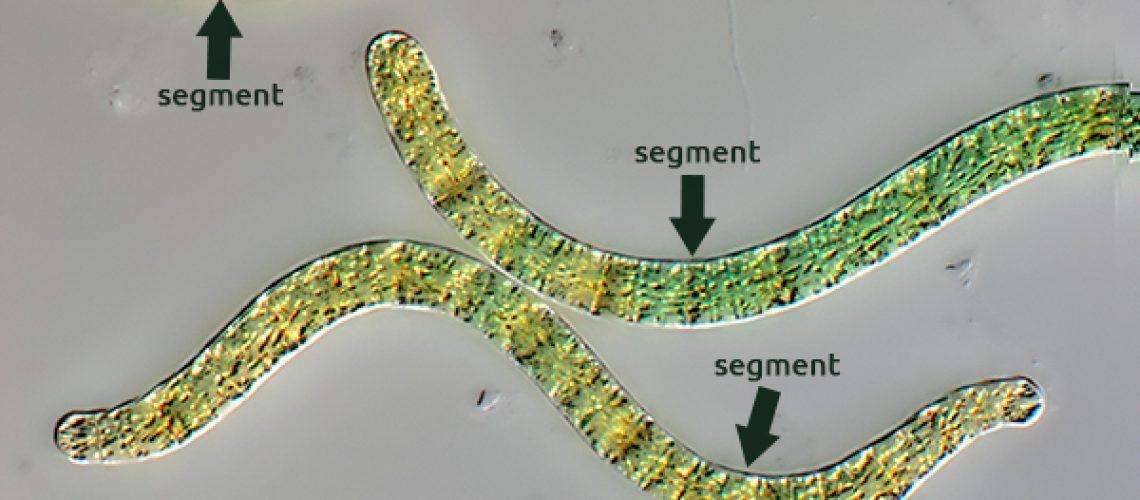 Spirulina at 10 micron magnification - Spirulina under the microscope